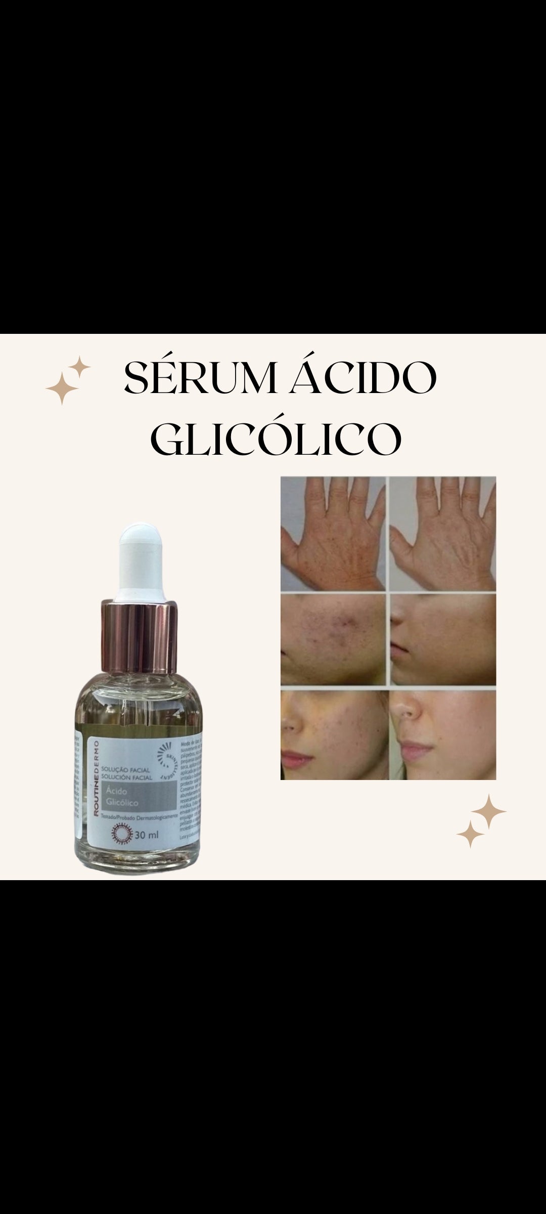 Acido glicolico